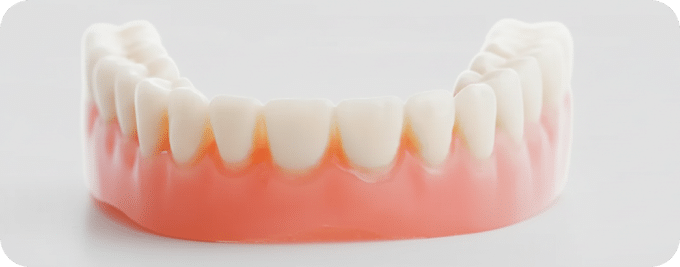 zahnarztpraxis-daimlerstrasse-25-zahnarzt-meppen-vollprothese-unterkiefer